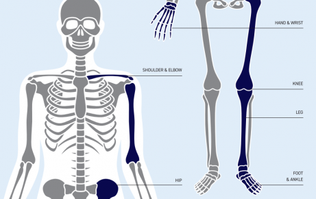 Vật tư nẹp vít chỉnh hình - chấn thương 